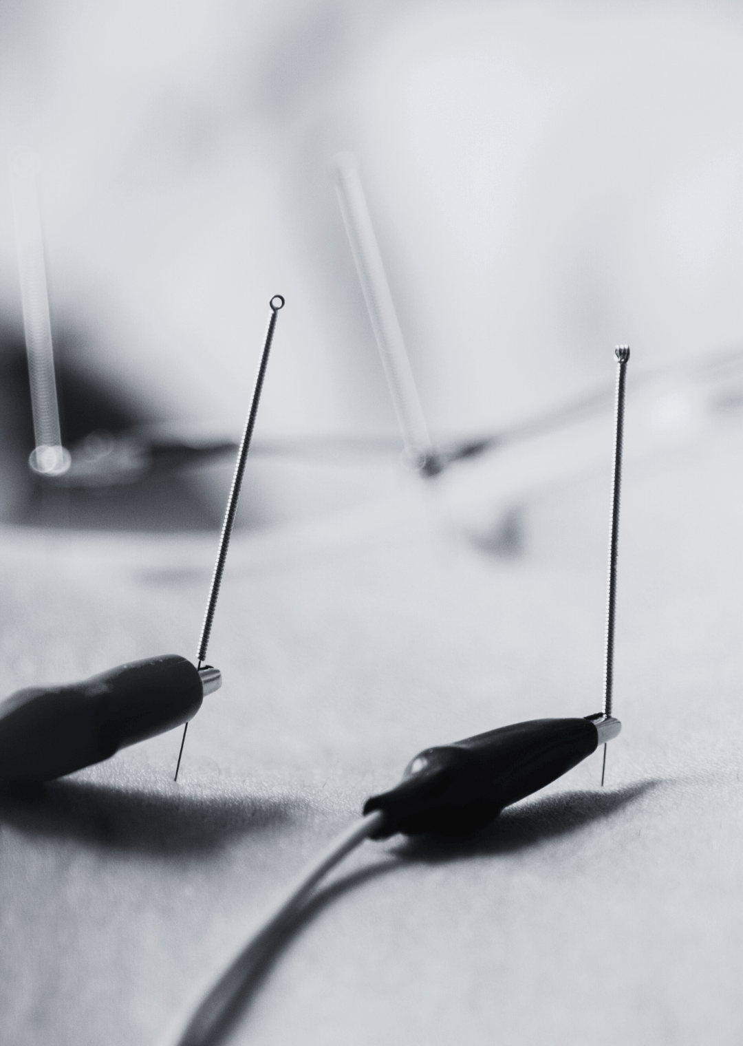 XVI Curso ElectroNeuroAcupuntura